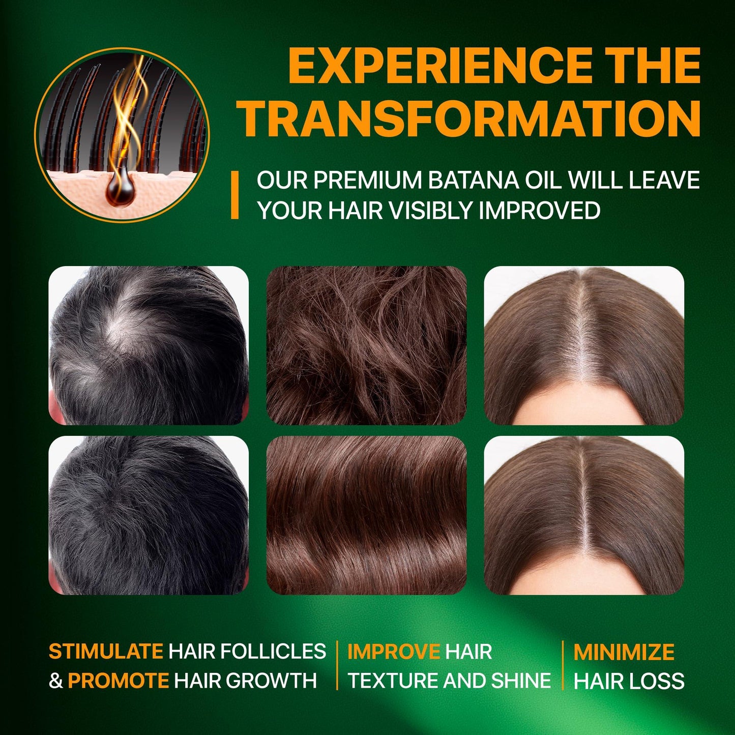 100% Raw Batana Oil for Hair Growth from Honduras, Dr Sebi Batana Oil, Promotes Hair Density, Reduces Split Ends, 100 Percent Pure Batana Oil for Women and Men 4.23oz